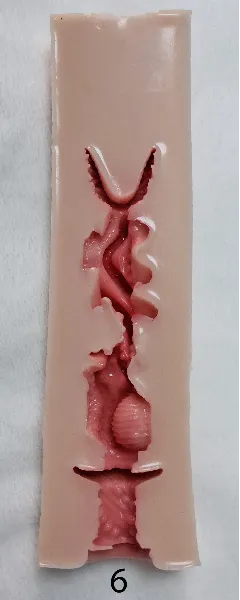 #6(15cm)
